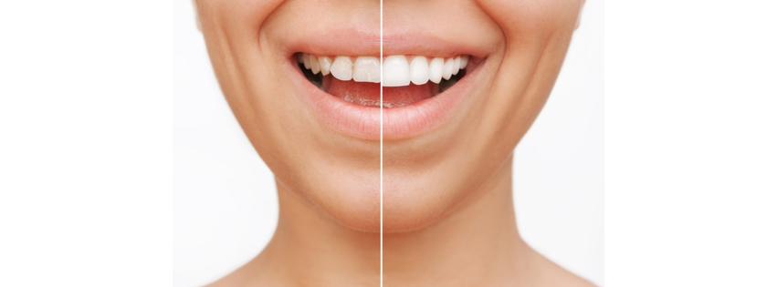 Deccan Dental - Samir Nanjapa DDS San Mateo