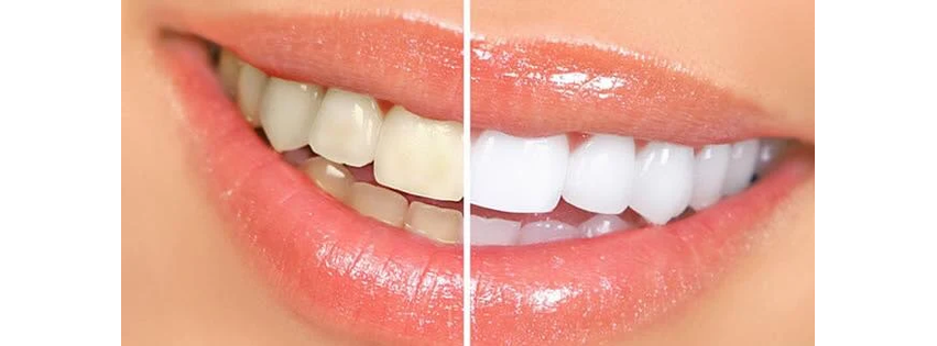 Corona Family Dental at Spring Forest