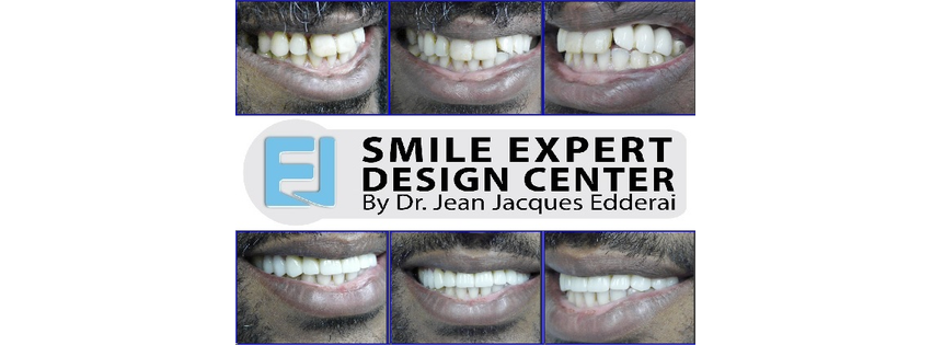 SMILE EXPERT DESIGN CENTER by Dr. Jean-Jacques Edderai