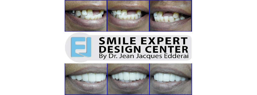 SMILE EXPERT DESIGN CENTER by Dr. Jean-Jacques Edderai