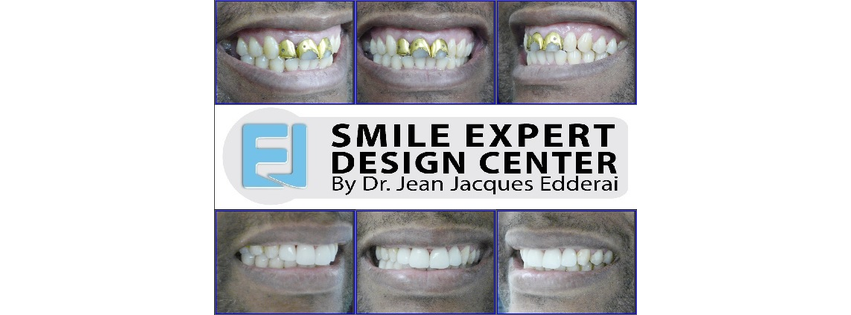 SMILE EXPERT DESIGN CENTER by Dr. Jean-Jacques Edderai