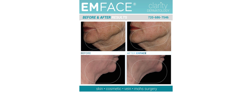 Clarity Dermatology